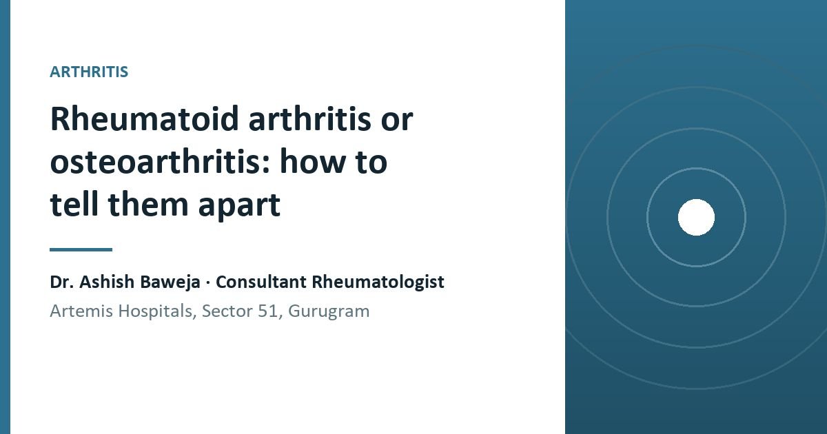 How to tell rheumatoid arthritis from osteoarthritis: which joints, how long the morning stiffness lasts, and what tests can and cannot decide.