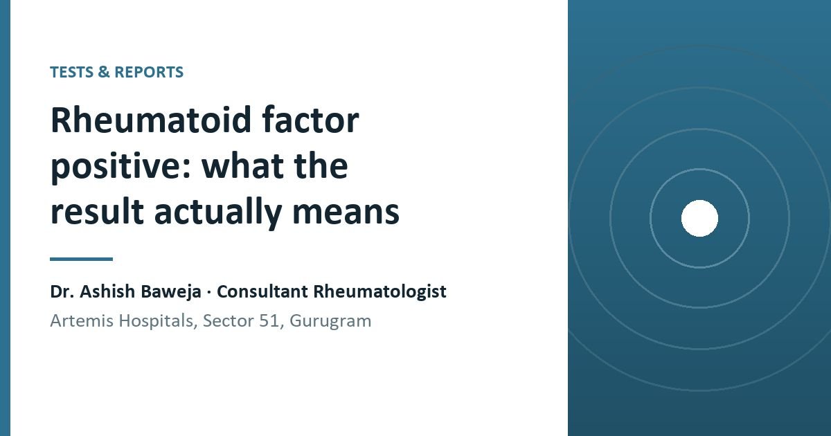A raised rheumatoid factor is common in people who are perfectly well. What the test measures, what the number means, and what decides whether it matters.